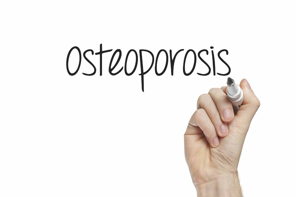 Osteoporosis las vegas