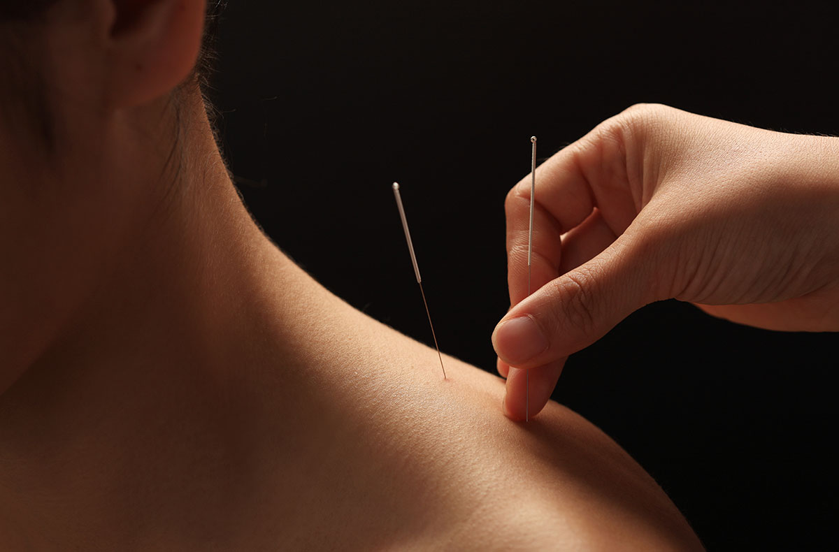 acupuncture las vegas